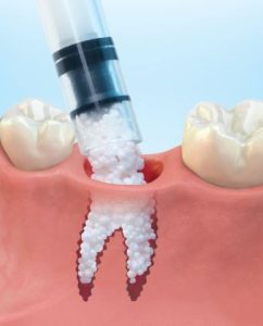 easygraft-pro (1) easygraft-pro (1)